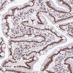 SAM68 Antibody in Immunohistochemistry (Paraffin) (IHC (P))