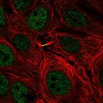 TMEM8A Polyclonal Antibody