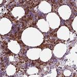 TMEM8A Antibody in Immunohistochemistry (Paraffin) (IHC (P))