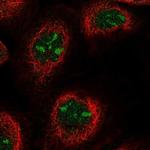 ANKRD18A Polyclonal Antibody