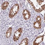 ANKRD18A Antibody in Immunohistochemistry (Paraffin) (IHC (P))