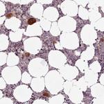 LAPTM5 Antibody in Immunohistochemistry (Paraffin) (IHC (P))