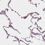 LAPTM5 Antibody in Immunohistochemistry (Paraffin) (IHC (P))