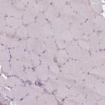 LAPTM5 Antibody in Immunohistochemistry (Paraffin) (IHC (P))