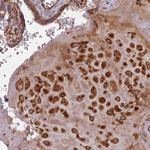 GBGT1 Antibody in Immunohistochemistry (Paraffin) (IHC (P))