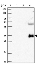 GBGT1 Antibody in Western Blot (WB)
