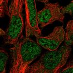 DAAM2 Polyclonal Antibody