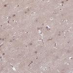 DAAM2 Antibody in Immunohistochemistry (Paraffin) (IHC (P))