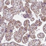 DAAM2 Antibody in Immunohistochemistry (Paraffin) (IHC (P))