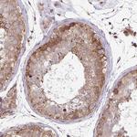 DAAM2 Antibody in Immunohistochemistry (Paraffin) (IHC (P))