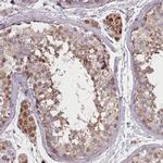 ZMYM4 Antibody in Immunohistochemistry (IHC)