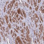 TOMM40L Polyclonal Antibody