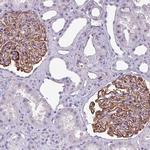 KIAA0317 Polyclonal Antibody