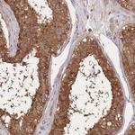 SLC4A9 Polyclonal Antibody