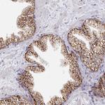 C18orf25 Antibody in Immunohistochemistry (Paraffin) (IHC (P))
