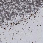 SH2D7 Polyclonal Antibody