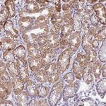 SMIM11 Antibody in Immunohistochemistry (Paraffin) (IHC (P))