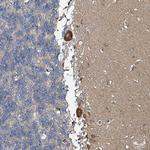 B3GAT3 Polyclonal Antibody