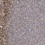 MTMR12 Polyclonal Antibody