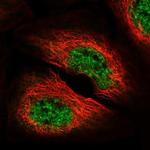 DGKZ Polyclonal Antibody