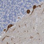DGKZ Antibody in Immunohistochemistry (IHC)
