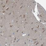 DGKZ Antibody in Immunohistochemistry (IHC)