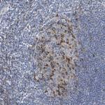 DGKZ Antibody in Immunohistochemistry (IHC)