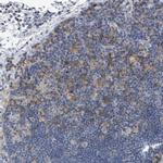 DGKZ Antibody in Immunohistochemistry (IHC)