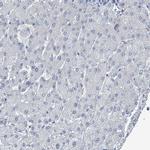 DGKZ Antibody in Immunohistochemistry (IHC)