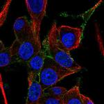 FAM171A1 Polyclonal Antibody