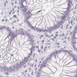 Synaptoporin Antibody in Immunohistochemistry (IHC)