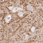 Synaptoporin Antibody in Immunohistochemistry (IHC)
