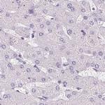 Synaptoporin Antibody in Immunohistochemistry (IHC)