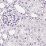 Synaptoporin Antibody in Immunohistochemistry (IHC)