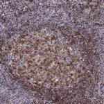 BACH2 Antibody in Immunohistochemistry (IHC)