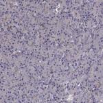 BACH2 Antibody in Immunohistochemistry (IHC)