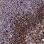 BACH2 Polyclonal Antibody