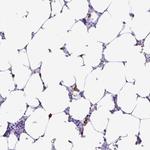 PIGF Antibody in Immunohistochemistry (Paraffin) (IHC (P))