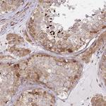 LARP1 Antibody in Immunohistochemistry (Paraffin) (IHC (P))