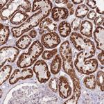 CNOT8 Polyclonal Antibody