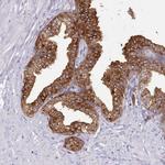 SRD5A1 Polyclonal Antibody