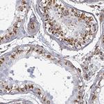 AGAP1 Polyclonal Antibody