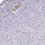 TTLL3 Polyclonal Antibody