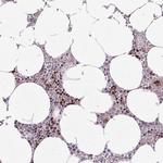 ZNF394 Polyclonal Antibody