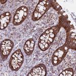 ALKBH4 Polyclonal Antibody