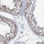 TUSC1 Antibody in Immunohistochemistry (IHC)