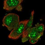 RIOK1 Polyclonal Antibody