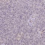 RIOK1 Antibody in Immunohistochemistry (Paraffin) (IHC (P))