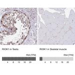 RIOK1 Antibody in Immunohistochemistry (IHC)