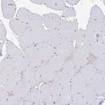 RIOK1 Antibody in Immunohistochemistry (IHC)